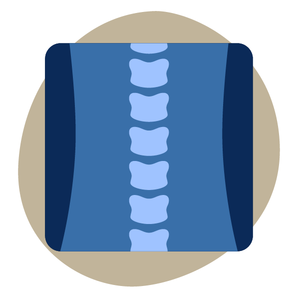 Ψηφιακή Ακτινογραφία