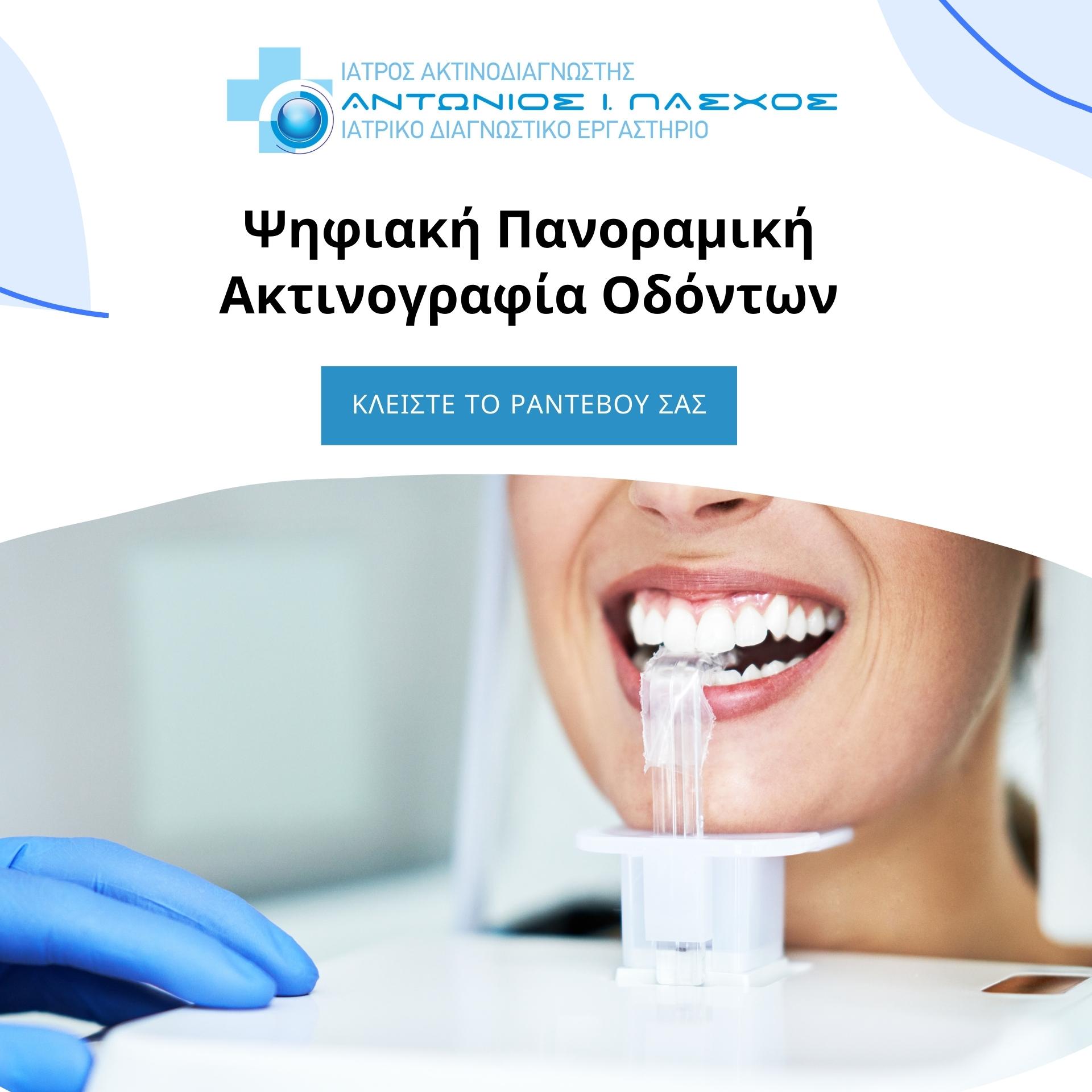 Ψηφιακή πανοραμική ακτινογραφία δοντιών